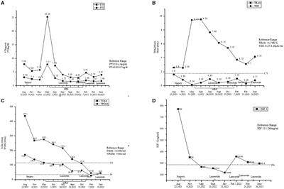 Mixed thyrotropin-secreting pituitary neuroendocrine tumor coexisting with Graves' disease: a case report